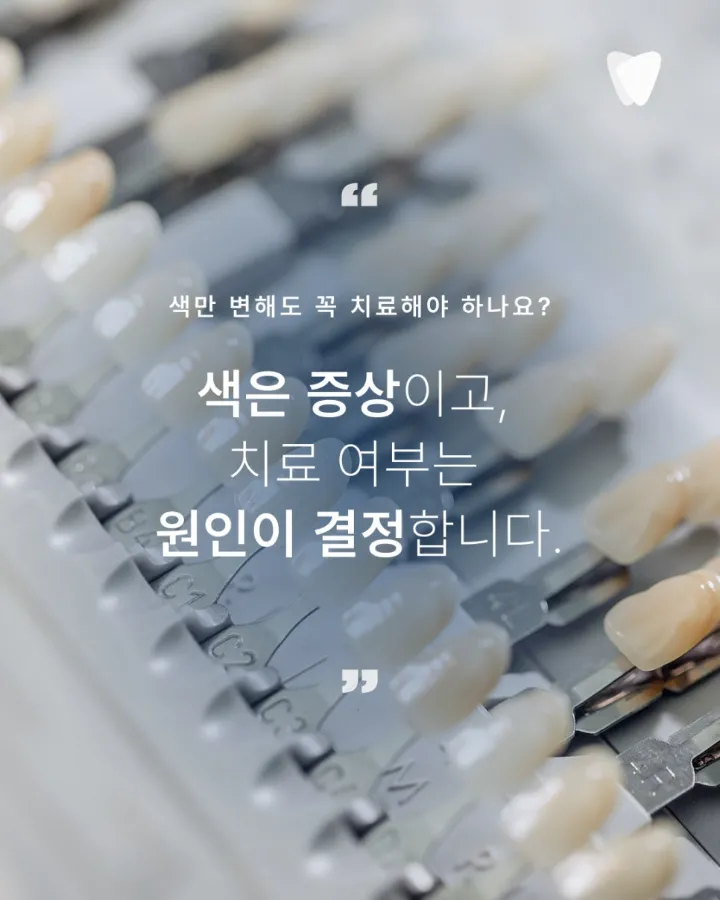 이미지 카드 · 치아색은 생각보다 많은 이야기를 품고 있습니다.