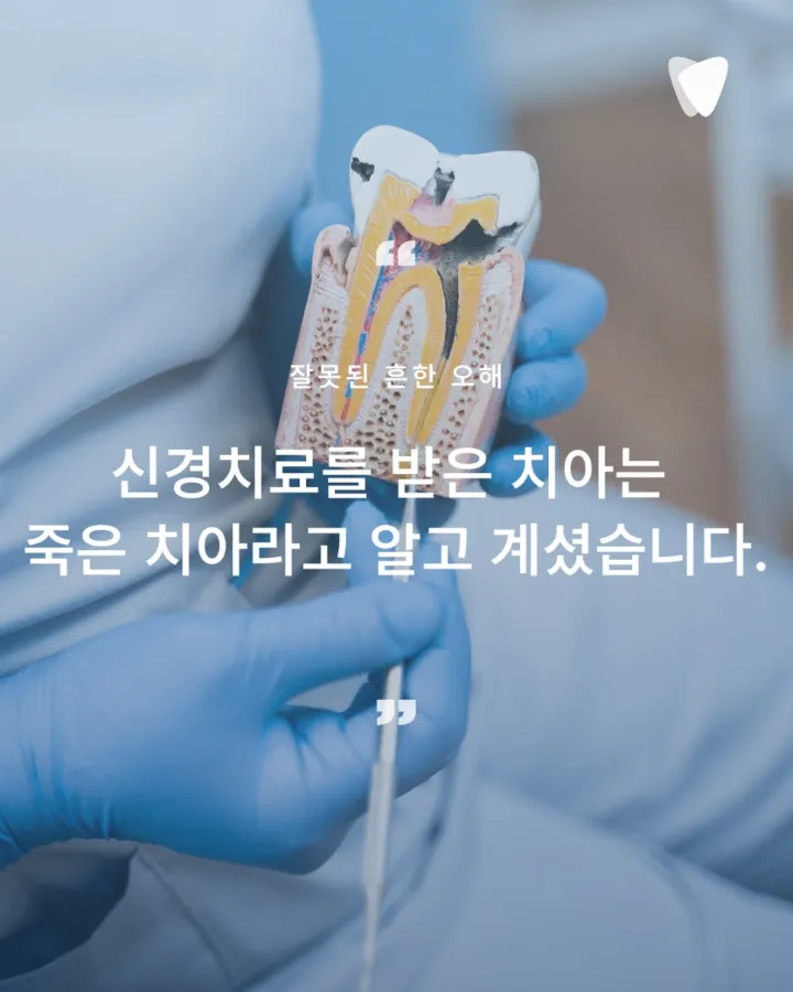 이미지 카드 · 신경치료 후 자연치아를 쉽게 빼지 않는 이유
