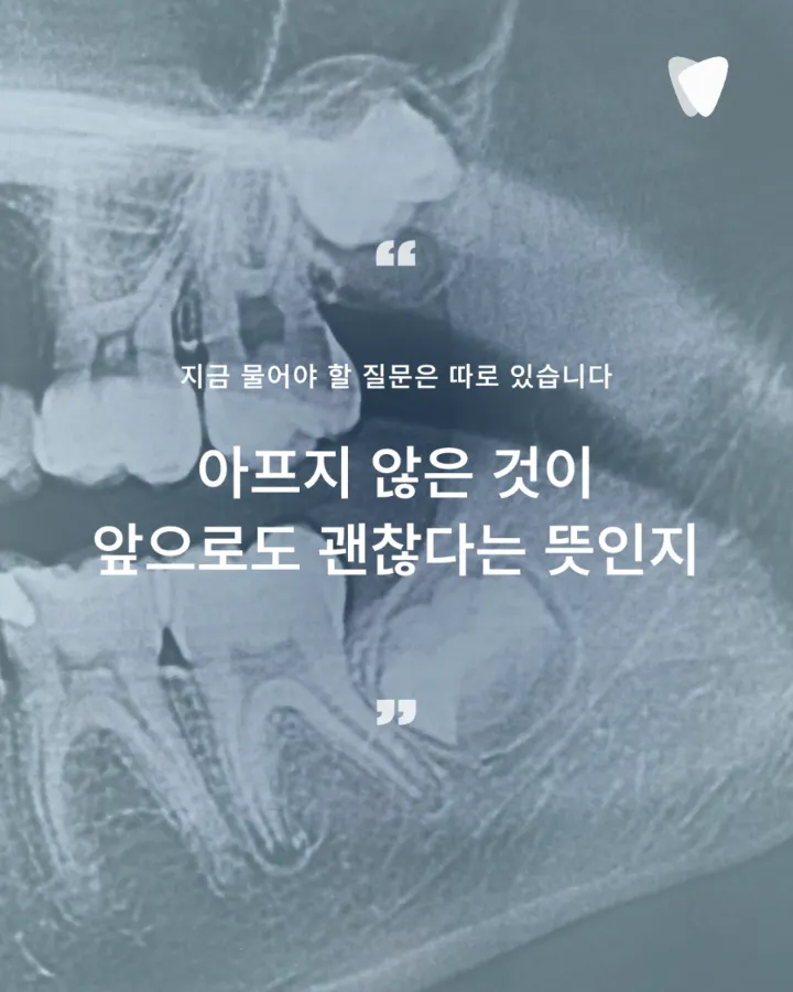 이미지 카드 · 사랑니 발치, 안 아프면 안 빼도 될까요? 판단 기준 정리
