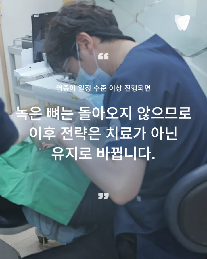 이미지 카드 · 임플란트 후 관리, 자연치아와 무엇이 다른가요 — 통증 없어도 확인해야 하는 이유