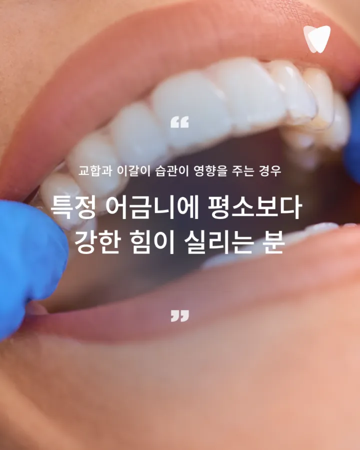 이미지 카드 · 어금니가 씹을 때 아픈 이유, 충치만 원인은 아닙니다