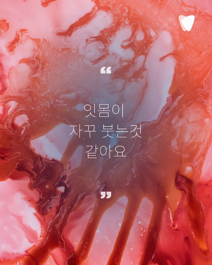 이미지 카드 · 당뇨가 있으면 잇몸이 더 약해질 수 있나요?