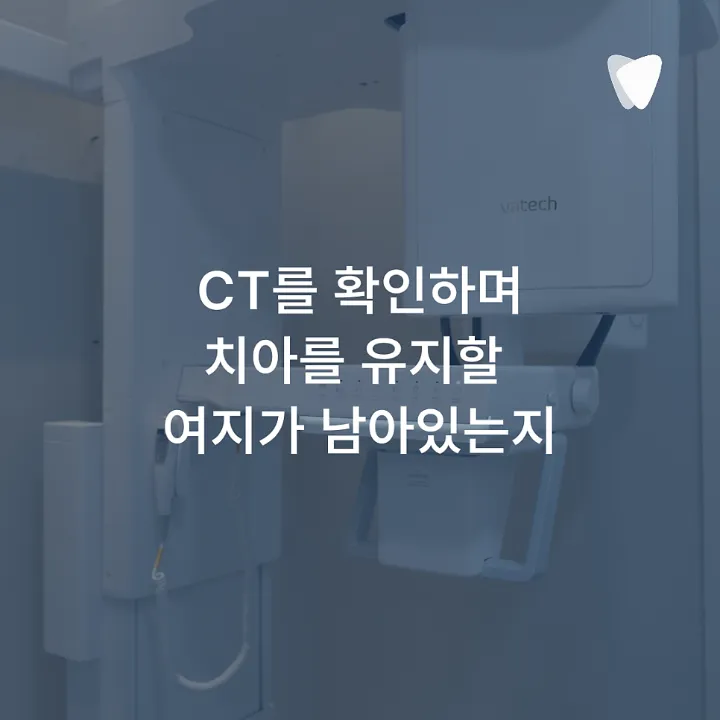 이미지 카드 · 운정 치아 뿌리 염증, 무조건 발치해야 할까요?