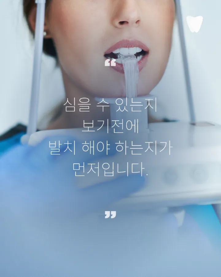 이미지 카드 · 운정 임플란트 상담 전, 자연치아를 먼저 확인하는 이유