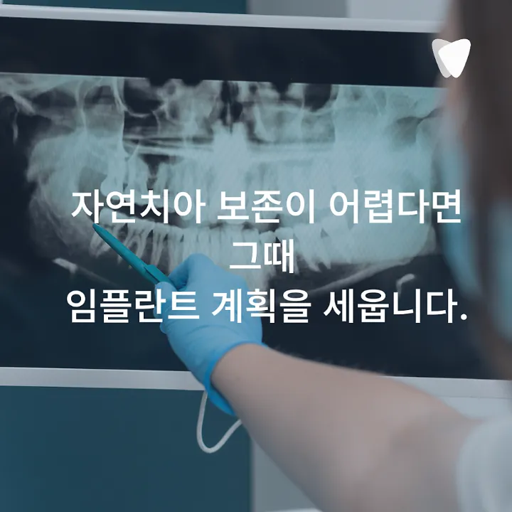 이미지 카드 · 운정 임플란트 상담 전, 자연치아를 먼저 확인하는 이유