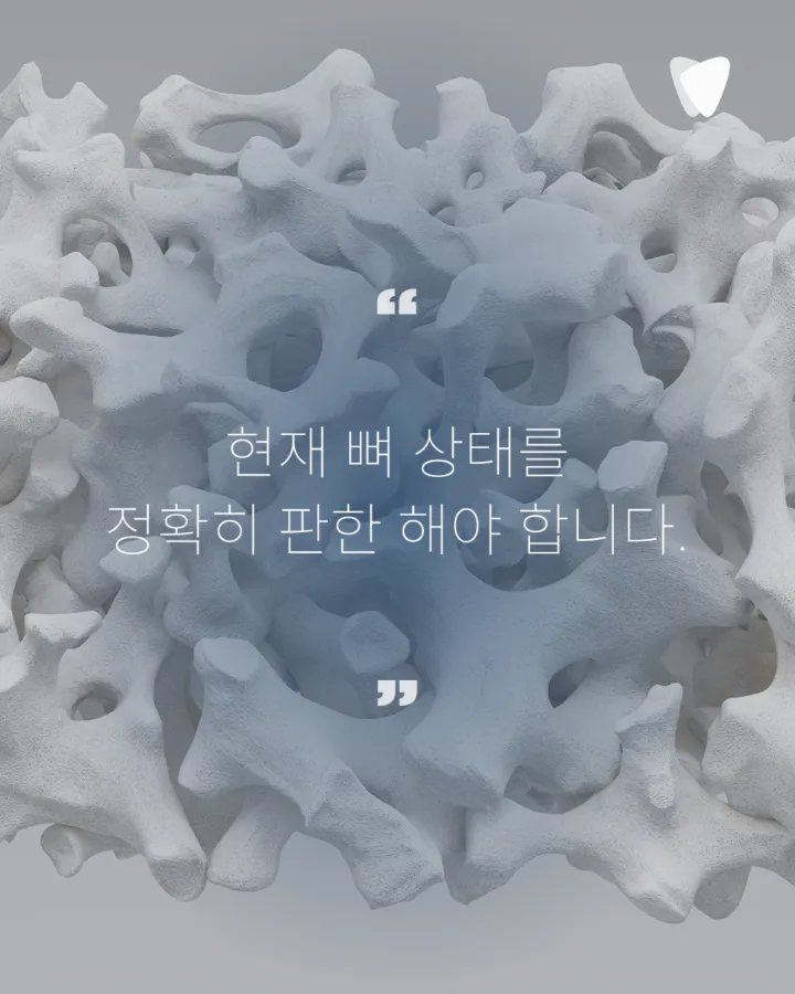 이미지 카드 · 운정 임플란트 비용, 숫자보다 먼저 확인해야 할 것