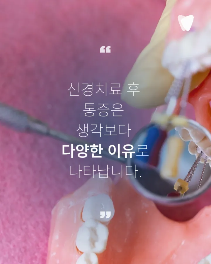 이미지 카드 · 신경치료 후에도 아픈 이유와 다시 봐야 할 부분
