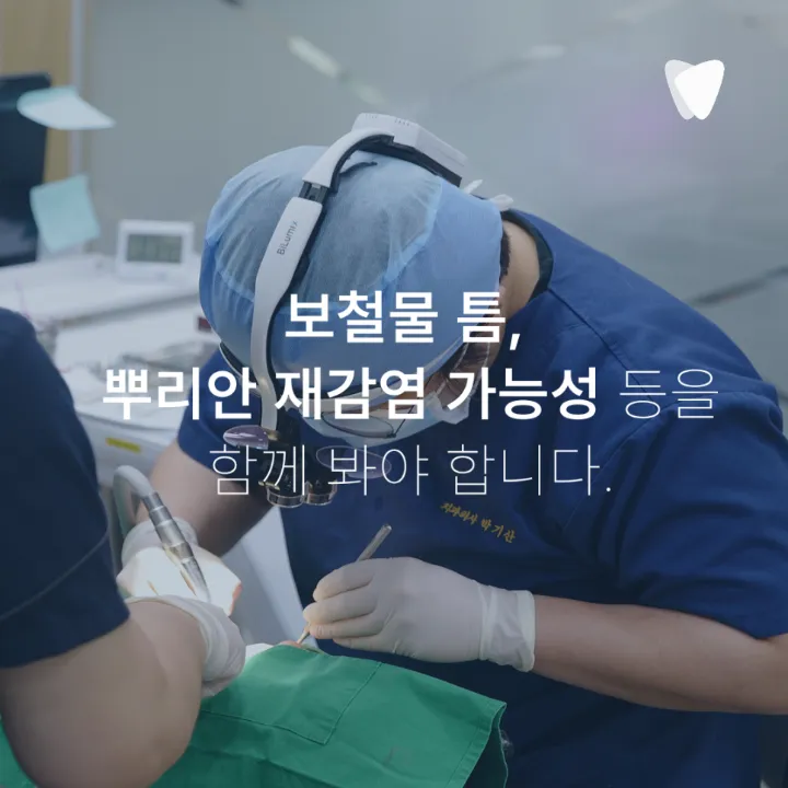 이미지 카드 · 신경치료 후에도 아픈 이유와 다시 봐야 할 부분