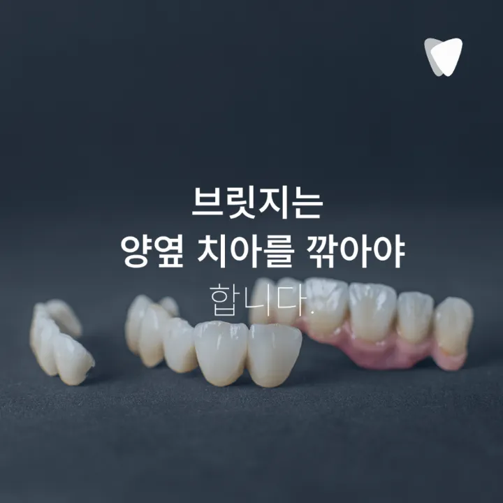 이미지 카드 · 임플란트·틀니·브릿지, 부모님께 맞는 선택 기준