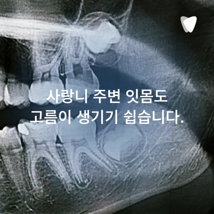 이미지 카드 · 잇몸이 붓고 고름이 날 때 먼저 의심할 수 있는 문제