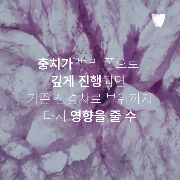 이미지 카드 · 재신경치료가 필요한 경우는 언제일까요?