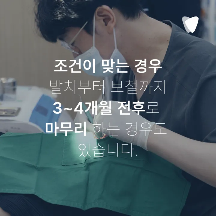 이미지 카드 · 임플란트 기간, 발치부터 보철까지 얼마나 걸릴까요?