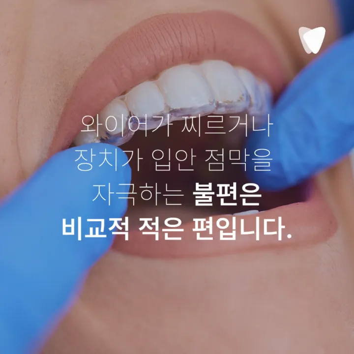 이미지 카드 · 투명교정 장점, 브라켓보다 편한 부분은 무엇일까요?