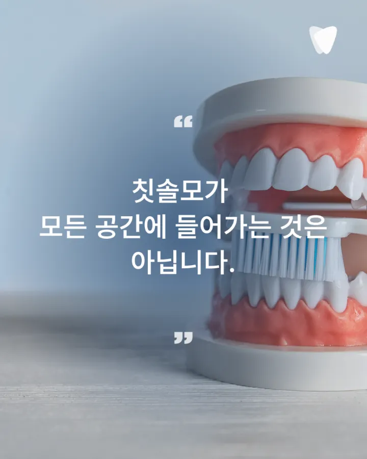 이미지 카드 · 양치해도 입냄새가 남는 이유, 치아와 잇몸에서 꼭 봐야 할 5가지