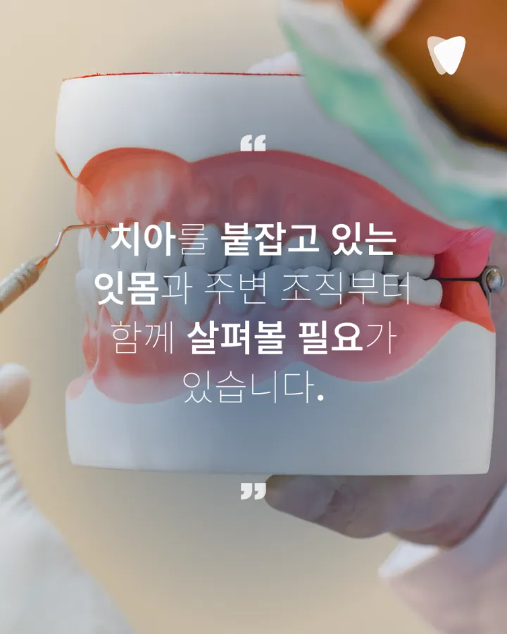 이미지 카드 · 치아가 흔들리는 느낌이 들 때 잇몸부터 봐야 하는 이유