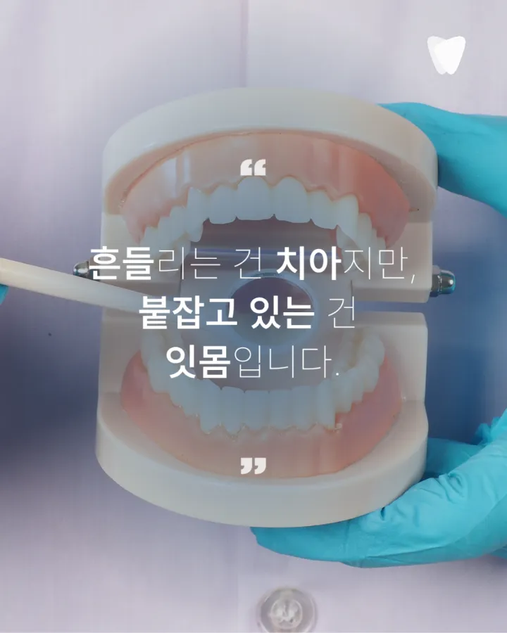 이미지 카드 · 치아가 흔들리는 느낌이 들 때 잇몸부터 봐야 하는 이유
