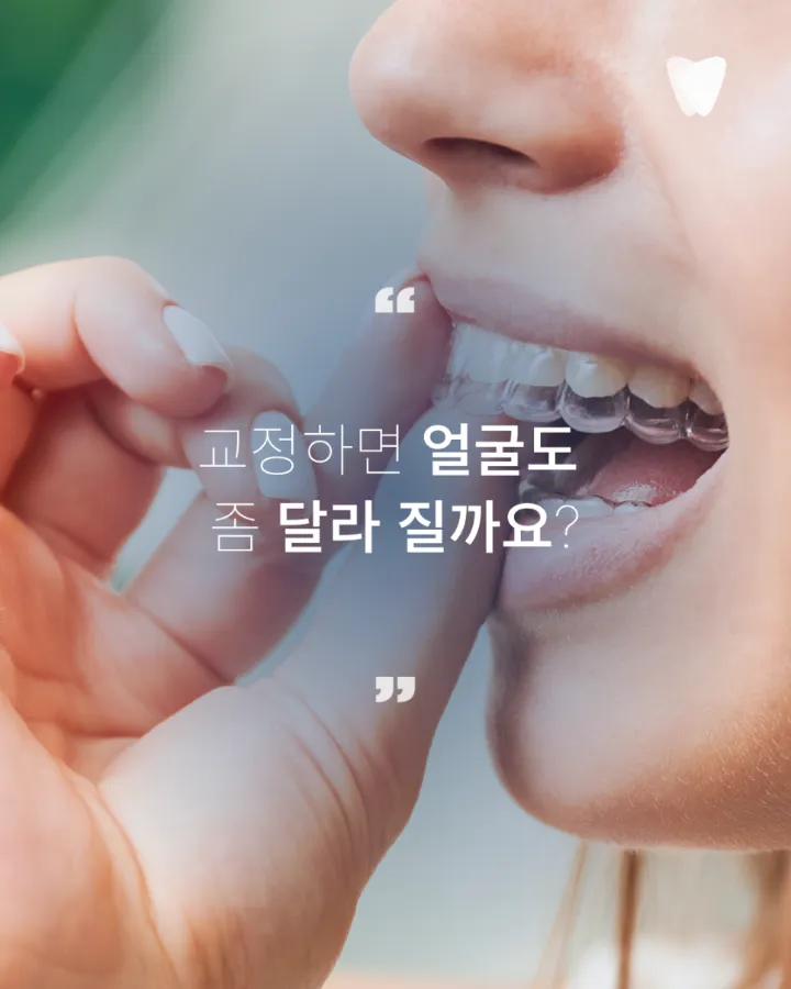 이미지 카드 · 돌출입 때문에 투명교정을 알아보고 계신가요?