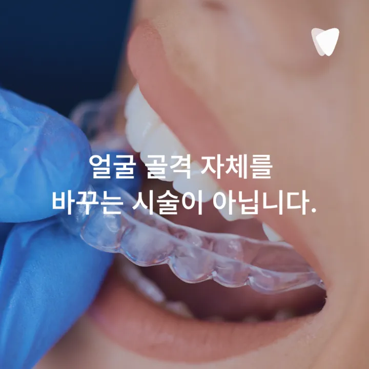이미지 카드 · 돌출입 때문에 투명교정을 알아보고 계신가요?