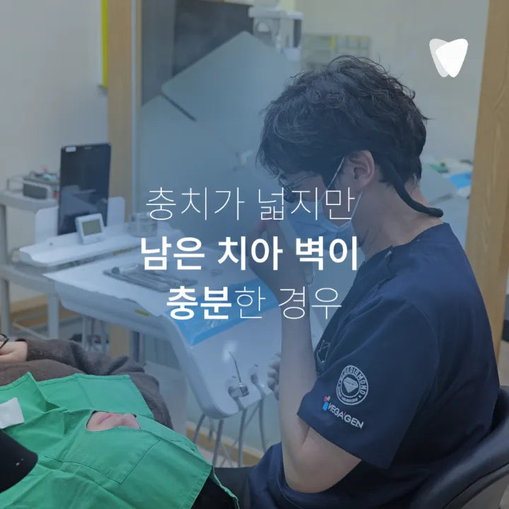 이미지 카드 · 충치가 깊어도 치아를 살릴 수 있는 경우