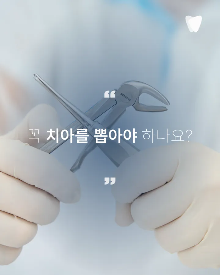 이미지 카드 · 운정 덧니 투명교정, 발치 없이 가능할까요?
