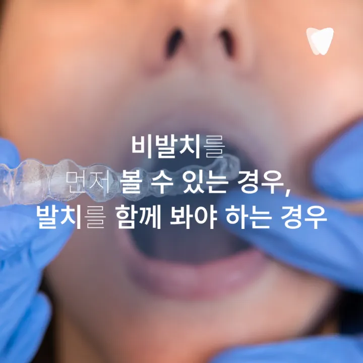 이미지 카드 · 운정 덧니 투명교정, 발치 없이 가능할까요?
