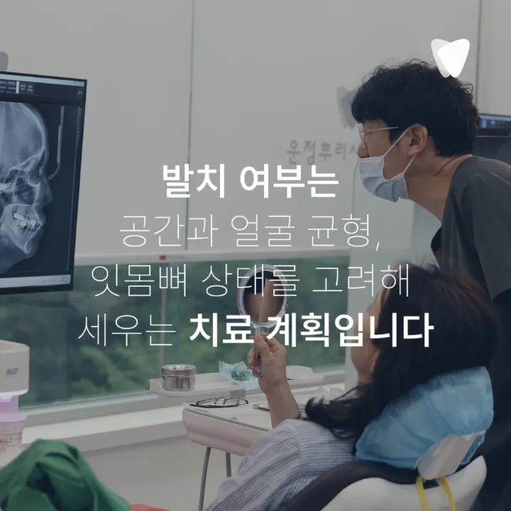 이미지 카드 · 운정 덧니 투명교정, 발치 없이 가능할까요?