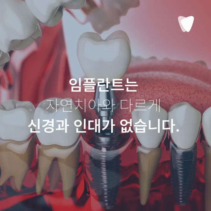 이미지 카드 · 운정 임플란트 수명, 오래 쓰려면 무엇이 중요할까요