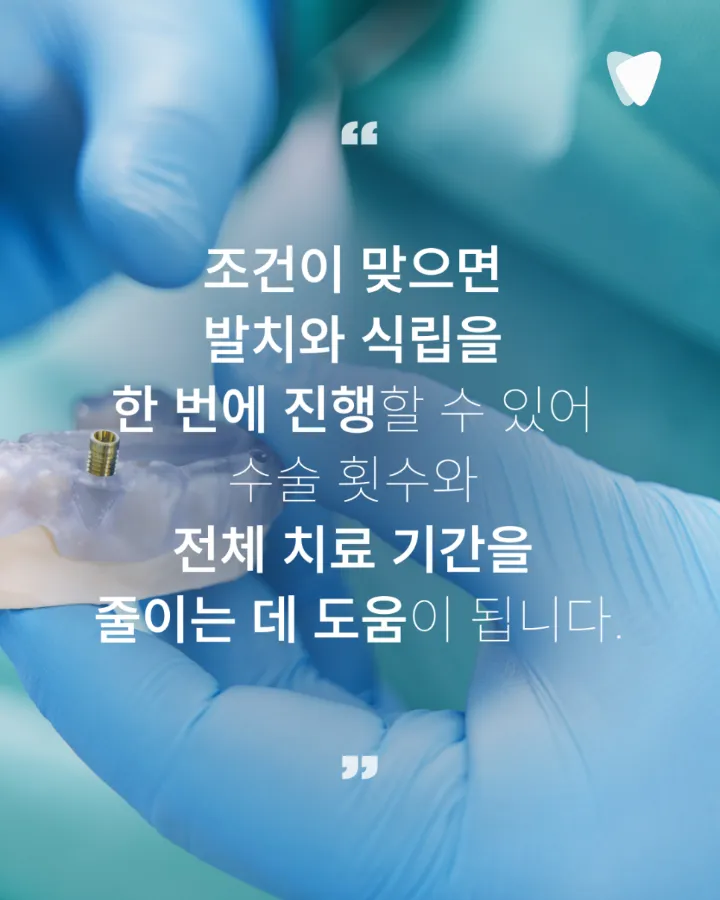 이미지 카드 · 운정 발치 후 임플란트 기간, 바로 할지 기다릴지 기준