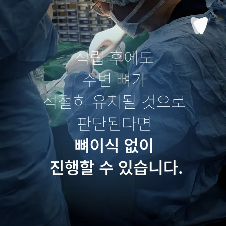 이미지 카드 · 임플란트 뼈이식, 꼭 해야 하는 경우와 아닌 경우