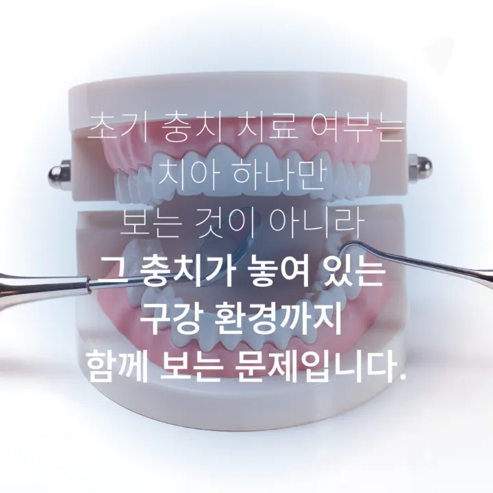 이미지 카드 · 초기 충치, 바로 치료할지 지켜볼지 결정하는 기준