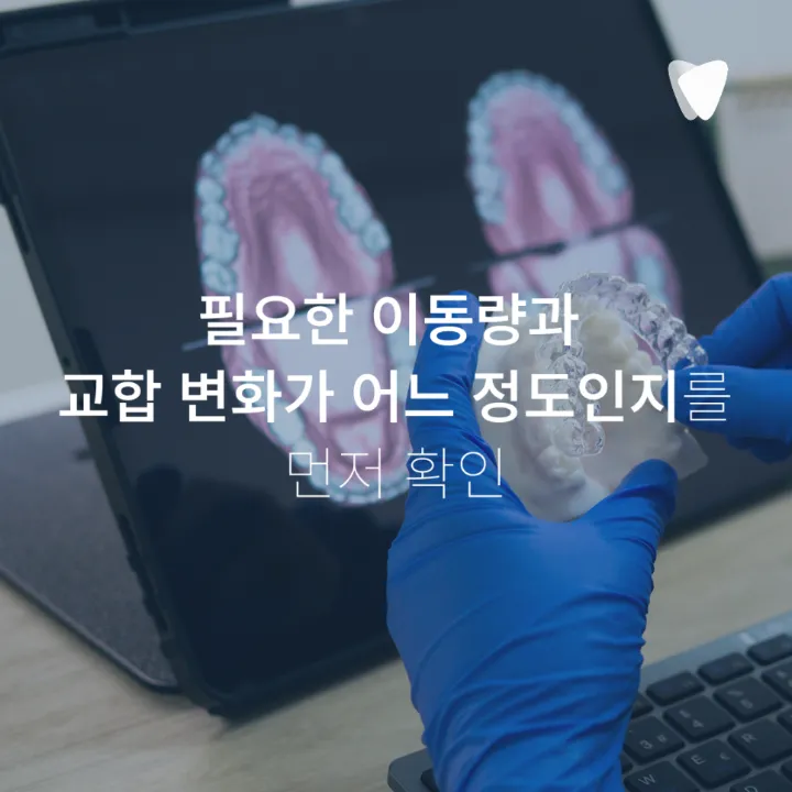 이미지 카드 · 투명교정 가능한 치아와 신중해야 하는 케이스, 무엇으로 나눌까요?
