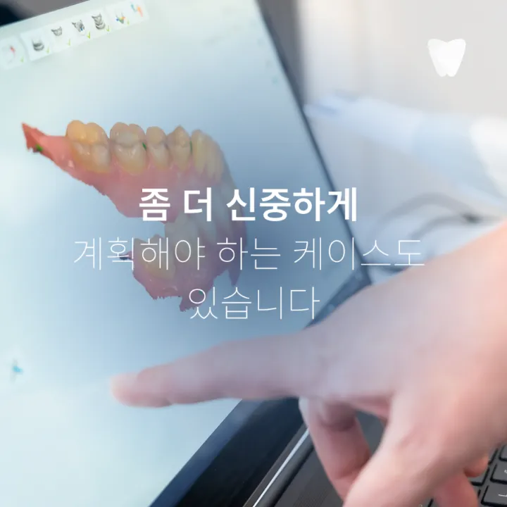 이미지 카드 · 투명교정 가능한 치아와 신중해야 하는 케이스, 무엇으로 나눌까요?