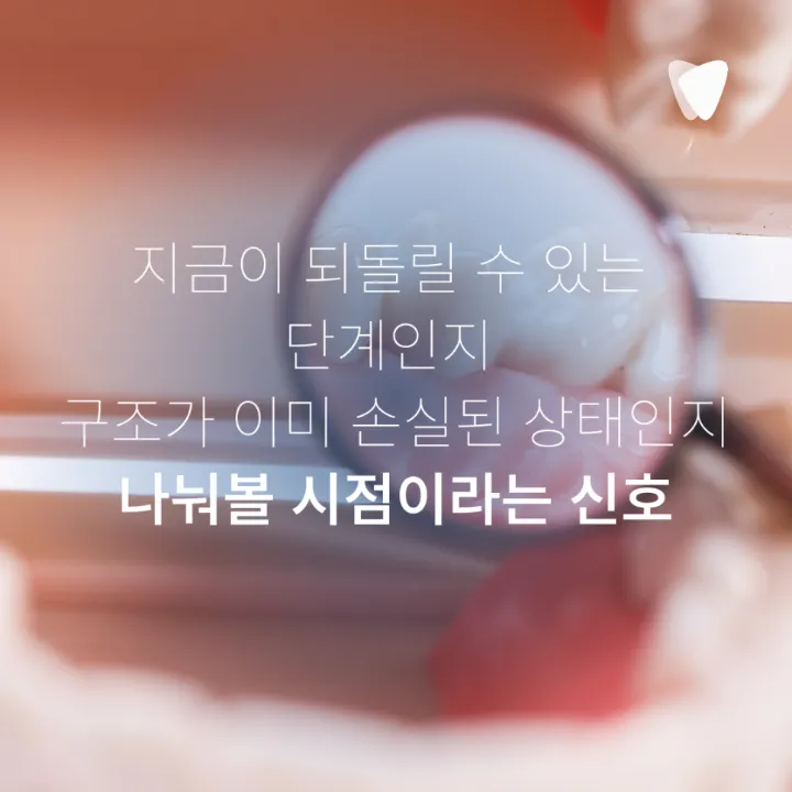 이미지 카드 · 치아 표면이 거칠어진 느낌이 들 때 확인할 것
