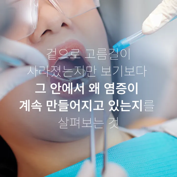 이미지 카드 · 뿌리 끝에 염증이 있는데 고름길이 반복되는 이유