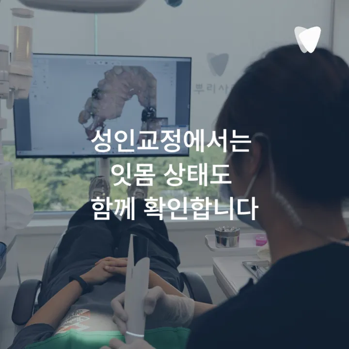 이미지 카드 · 30대 투명교정, 지금 시작해도 늦지 않을까요?