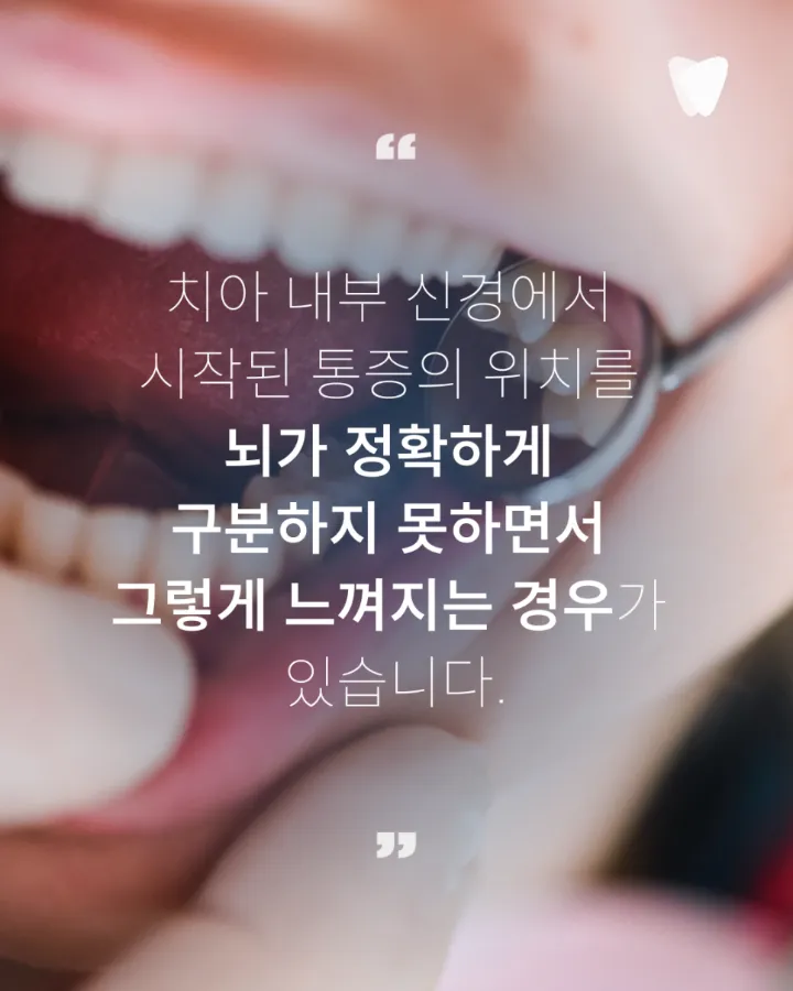 이미지 카드 · 어금니 안쪽이 묵직하게 아픈데 위치가 애매한 이유