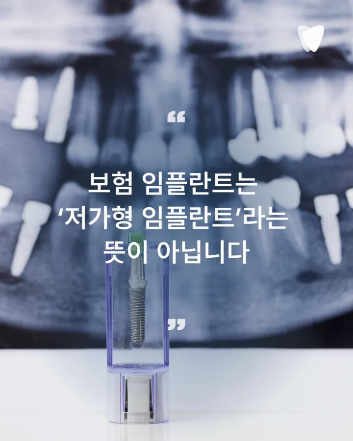 이미지 카드 · 보험 임플란트와 비보험 임플란트 차이, 무엇이 다를까요?
