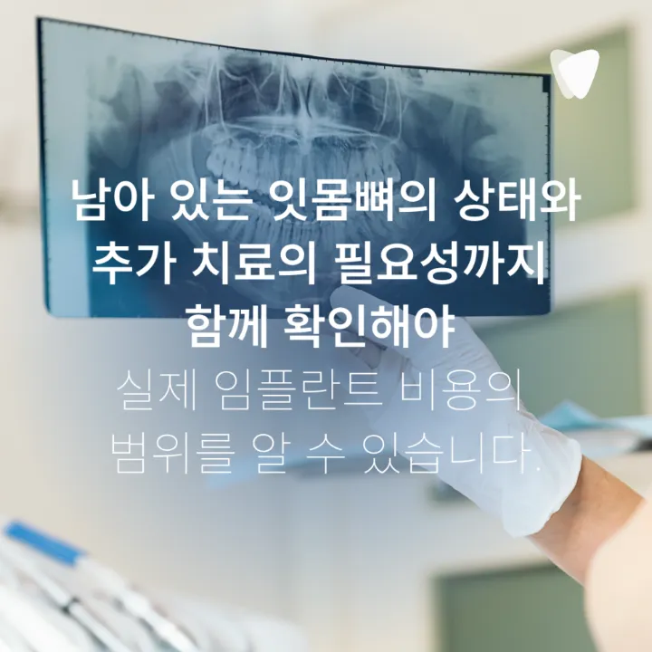 이미지 카드 · 보험 임플란트와 비보험 임플란트 차이, 무엇이 다를까요?