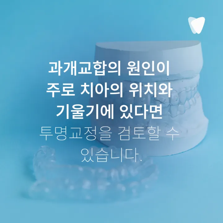 이미지 카드 · 과개교합 투명교정, 앞니가 깊게 물릴 때 무엇을 확인할까요?