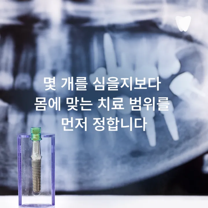 이미지 카드 · 70·80대 고령자 임플란트, 나이보다 먼저 보는 기준