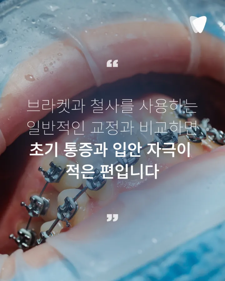이미지 카드 · 투명교정 통증, 처음 며칠은 어떤 느낌일까요?