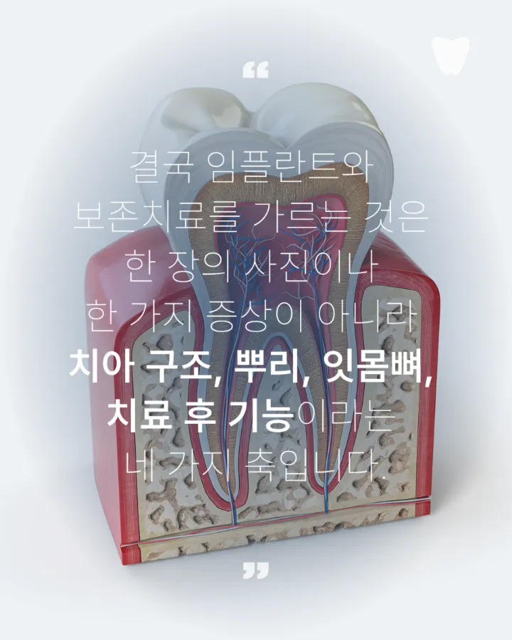 이미지 카드 · 치아를 살릴 수 있을까요? 임플란트와 보존치료를 나누는 기준