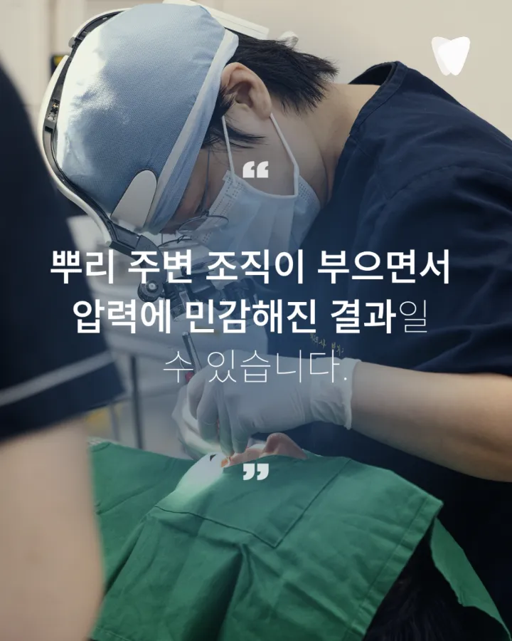 이미지 카드 · 치아를 톡톡 두드렸을 때 아픈 이유, 뿌리 주변 염증을 살피는 이유