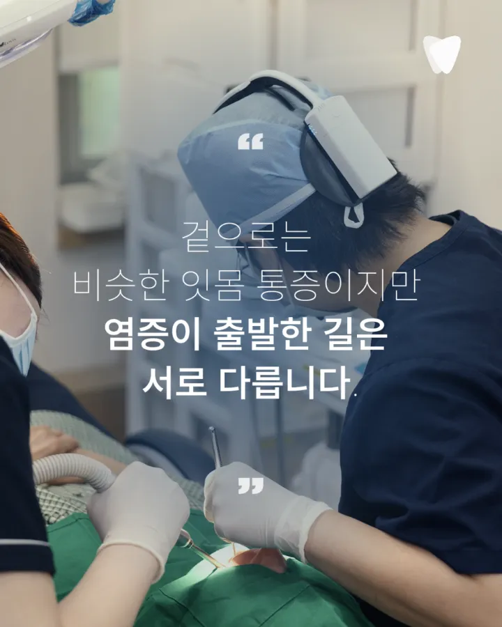 이미지 카드 · 치아와 잇몸 경계를 눌렀을 때 아픈 이유, 뿌리 끝 염증과 치주농양의 차이
