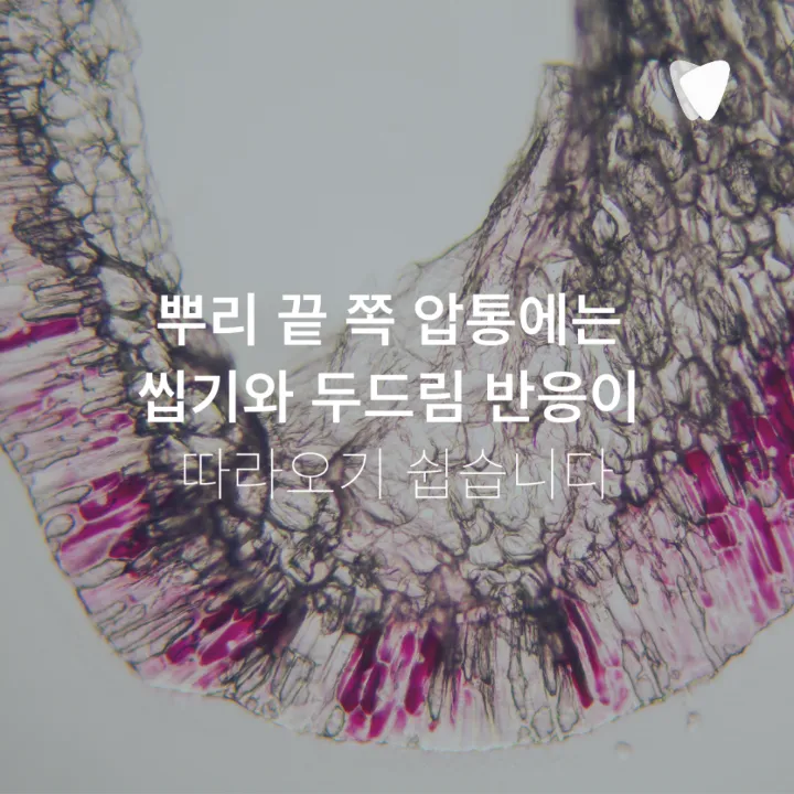 이미지 카드 · 치아와 잇몸 경계를 눌렀을 때 아픈 이유, 뿌리 끝 염증과 치주농양의 차이