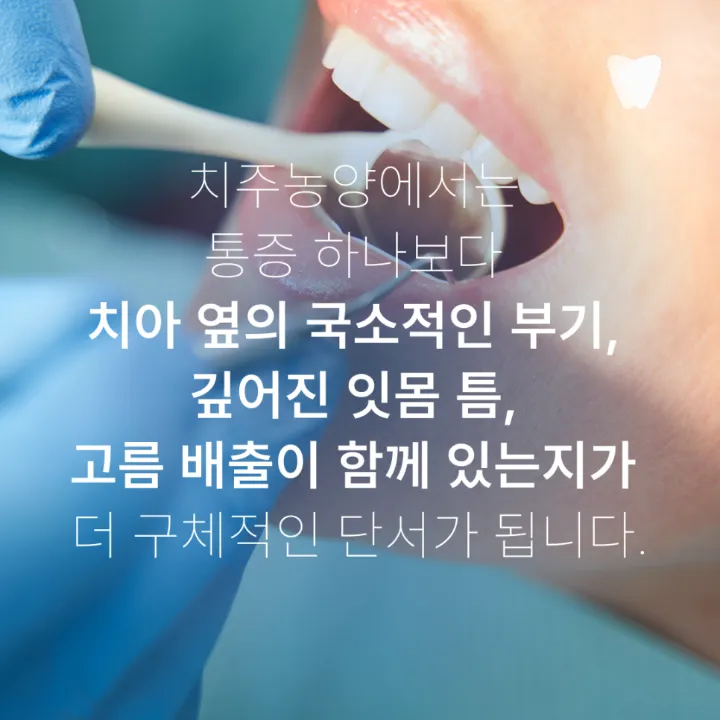 이미지 카드 · 치아와 잇몸 경계를 눌렀을 때 아픈 이유, 뿌리 끝 염증과 치주농양의 차이
