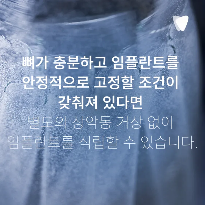 이미지 카드 · 상악동 거상술, 위 어금니 임플란트에서 필요한 경우
