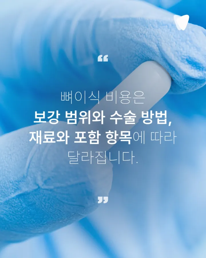 이미지 카드 · 임플란트 뼈이식 비용, 같은 뼈이식인데 왜 다를까요?