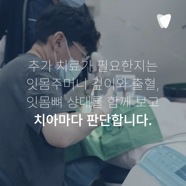 이미지 카드 · 스케일링과 잇몸치료는 어떻게 다를까요