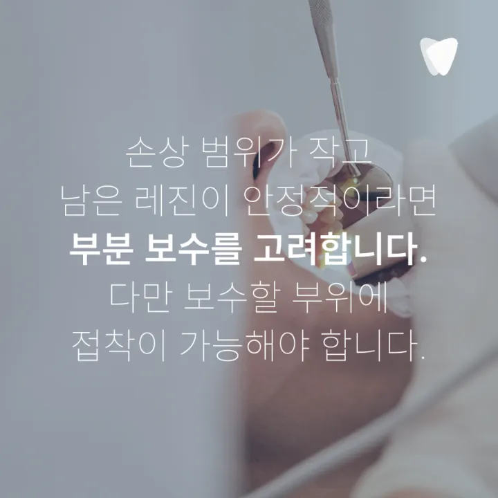 이미지 카드 · 레진 가장자리 변색, 재치료가 필요한 경우와 판단 기준